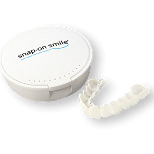 Съемные виниры Snap On Smile Съемные виниры Snap On Smile